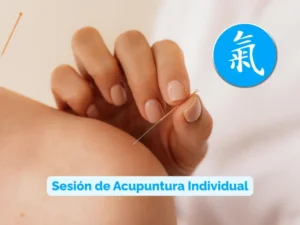 Acupuntura médica